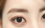 左眼皮上有痣的女人好不好呢 女人左眼皮上长有痣代表什么意思