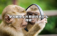 女人眼皮上长有痣代表什么预兆 眼皮上长有痣的女人好不好呢