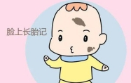菩萨送的孩子带胎记可以去掉吗图片 菩萨送的孩子带胎记左脚上有什么说法