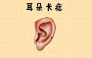 耳朵有痣代表什么 耳朵有痣的含义
