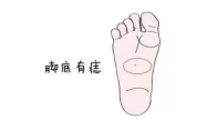 右脚脚底有痣代表什么 右脚脚底有痣的女人命运