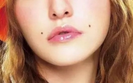 善痣恶痣有哪些区别 怎么区分痣是善痣还是恶痣