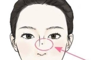 女人鼻子上的痣代表什么意思 女人鼻子上的痣可以点掉吗